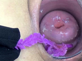 Dick In Cervix Porn